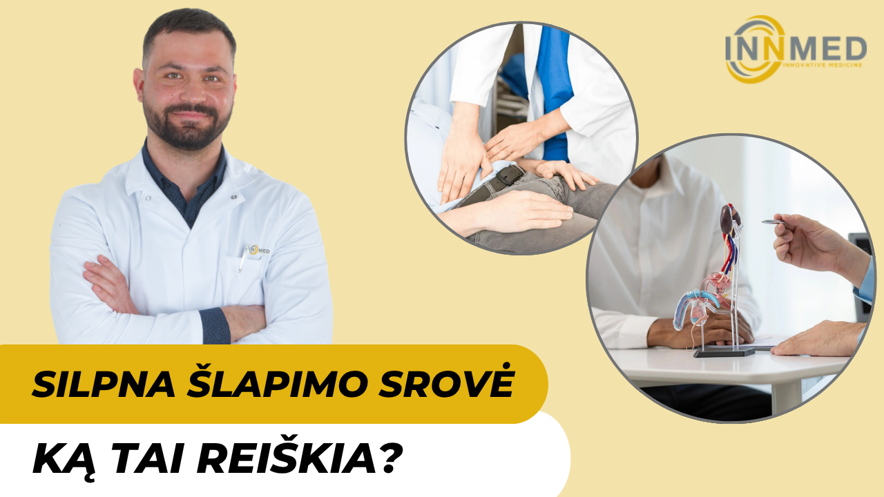 Silpna šlapimo srovė vyrams