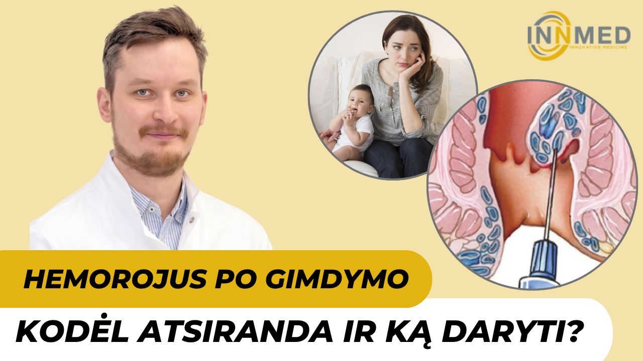 Hemorojus po gymdymo