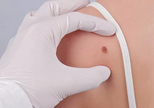 09-udalenie-novoobrazovanii