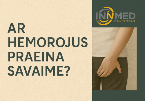 Ar hemorojus praeina savaime