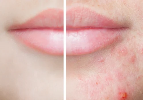 Odos-berimai-642x1024