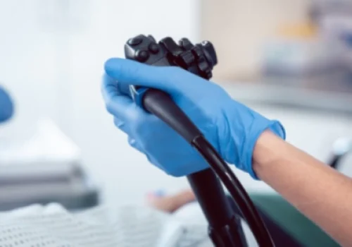 Rektoskopija-565x283