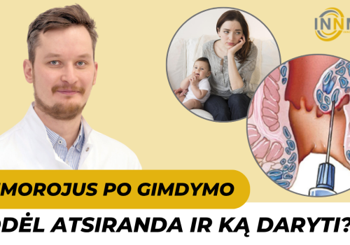 Hemorojus po gymdymo
