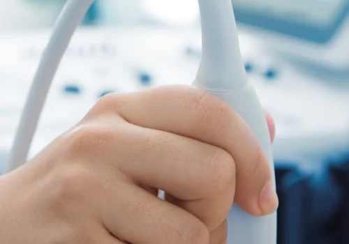 kraujagysliu-echoskopija-642x1024-1