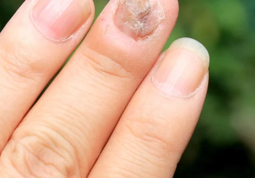 nagu-grybelis-642x1024