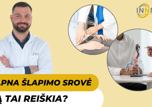 Silpna šlapimo srovė vyrams