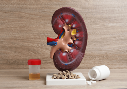 urologija3 (Medium)